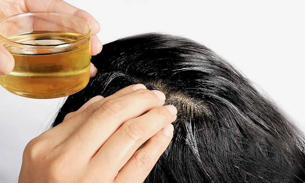 Natural Remedies for Hair Loss