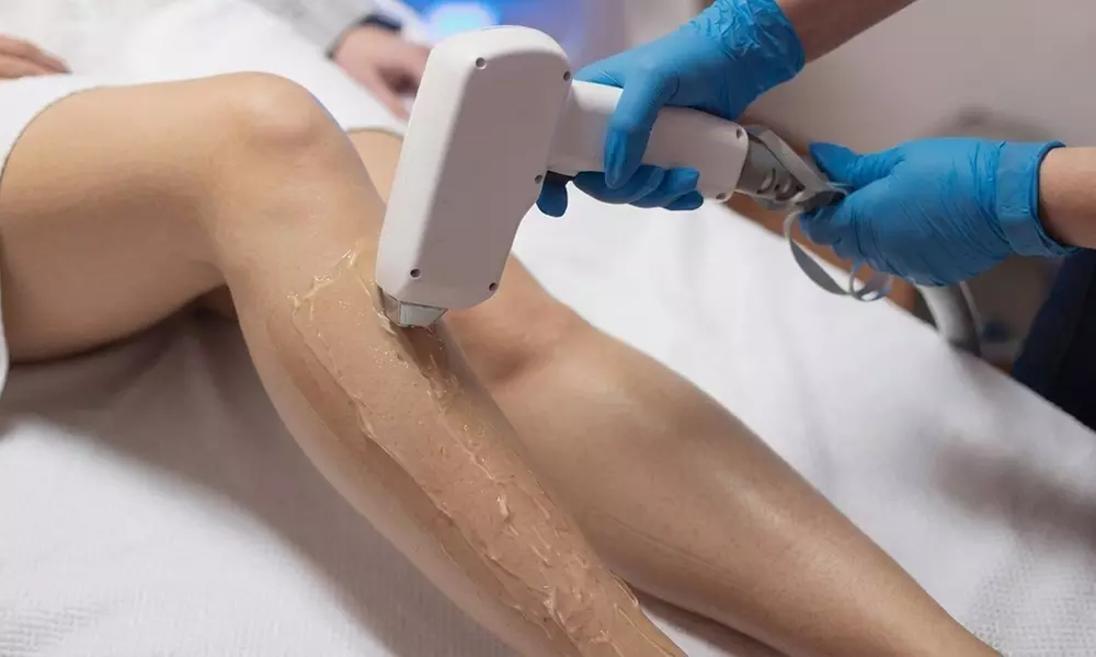 What to Do Before Laser Hair Removal?